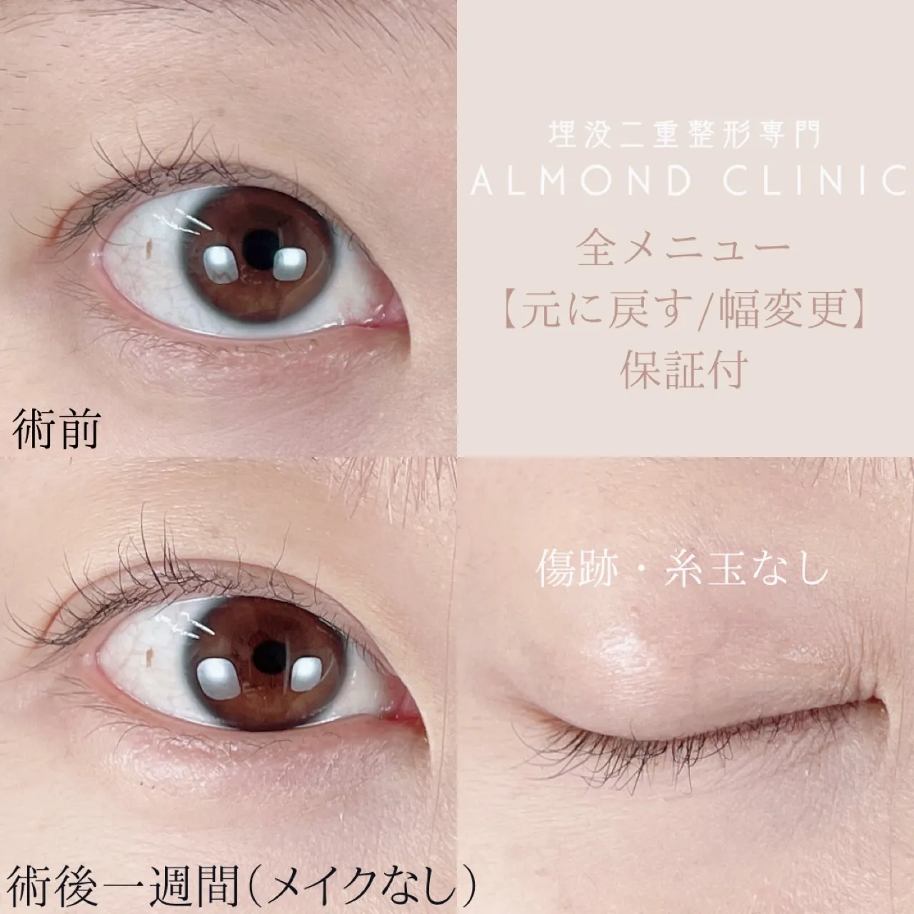 before・after画像