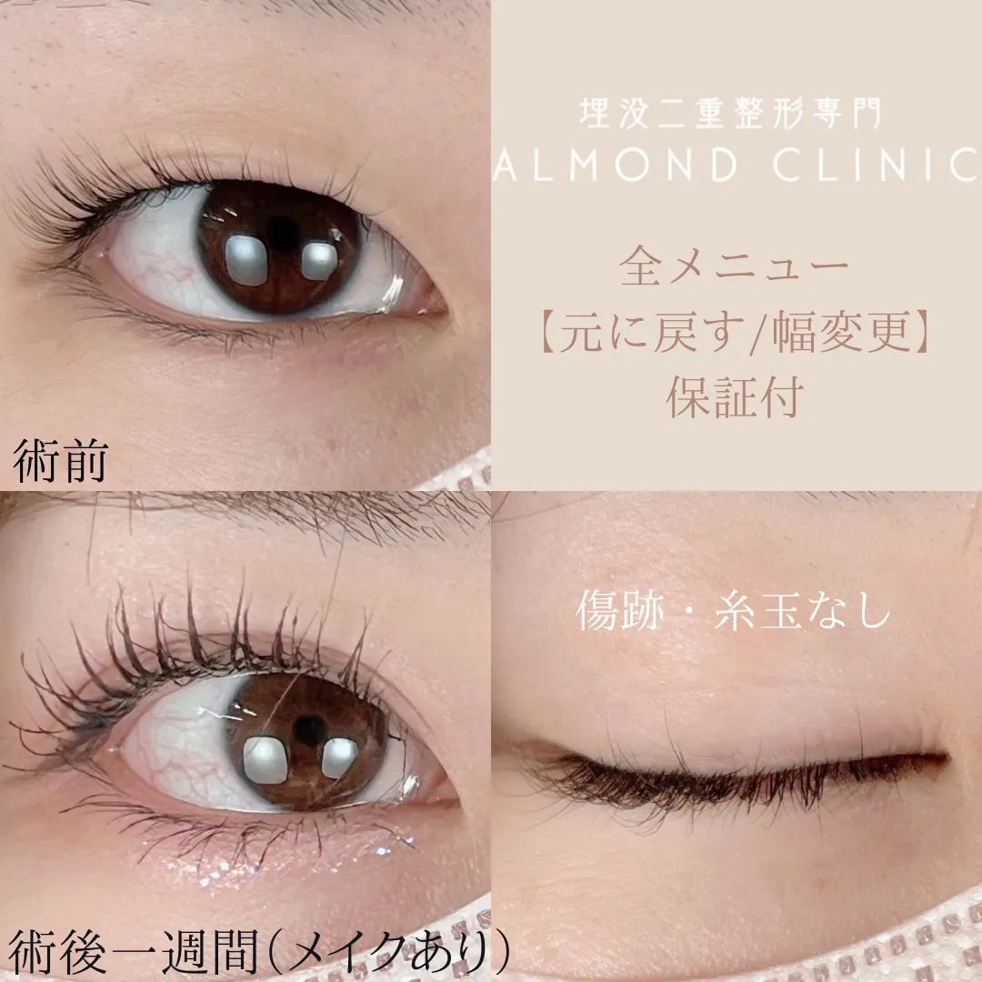 before・after画像