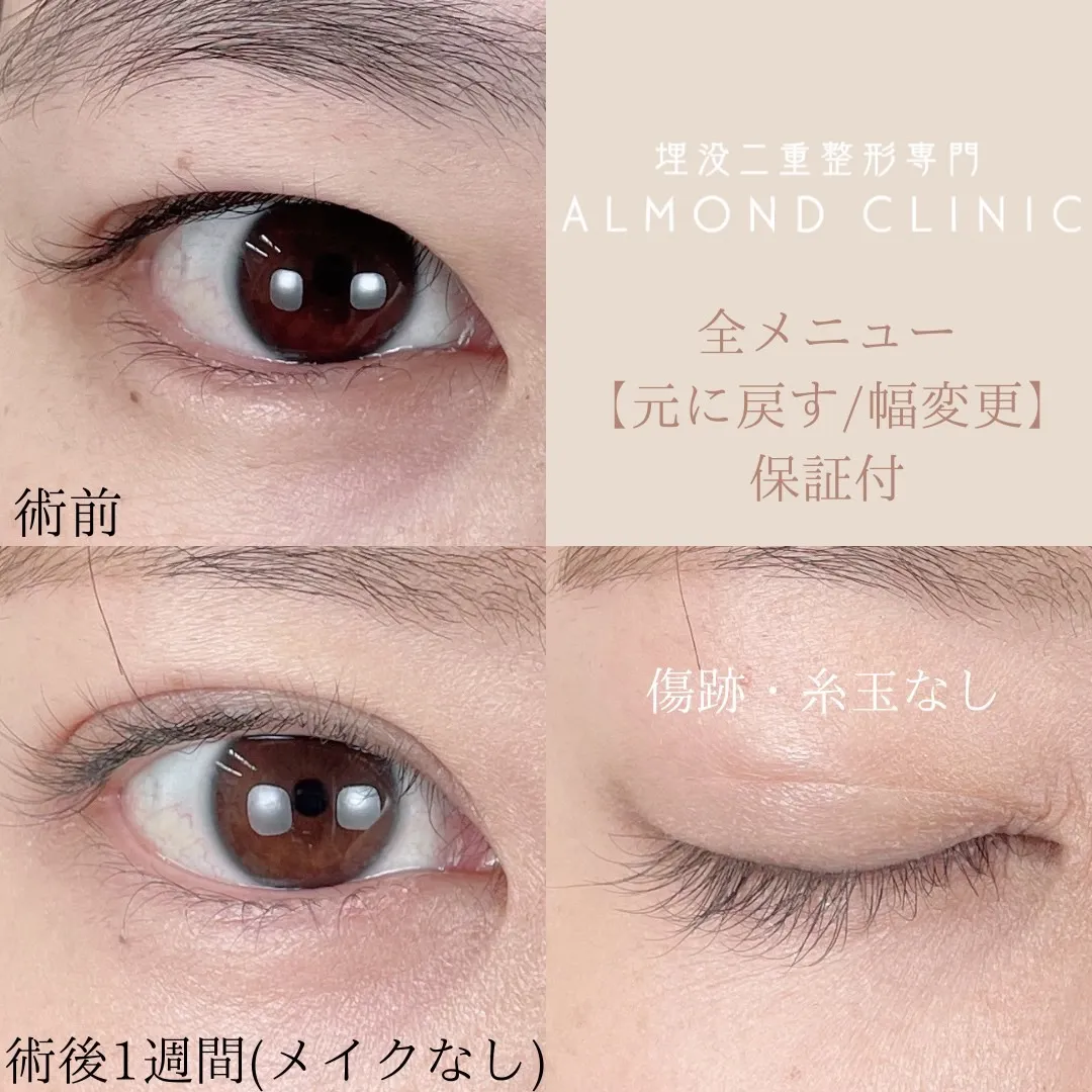 before・after画像