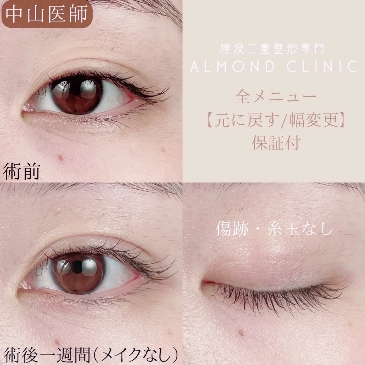 before・after画像