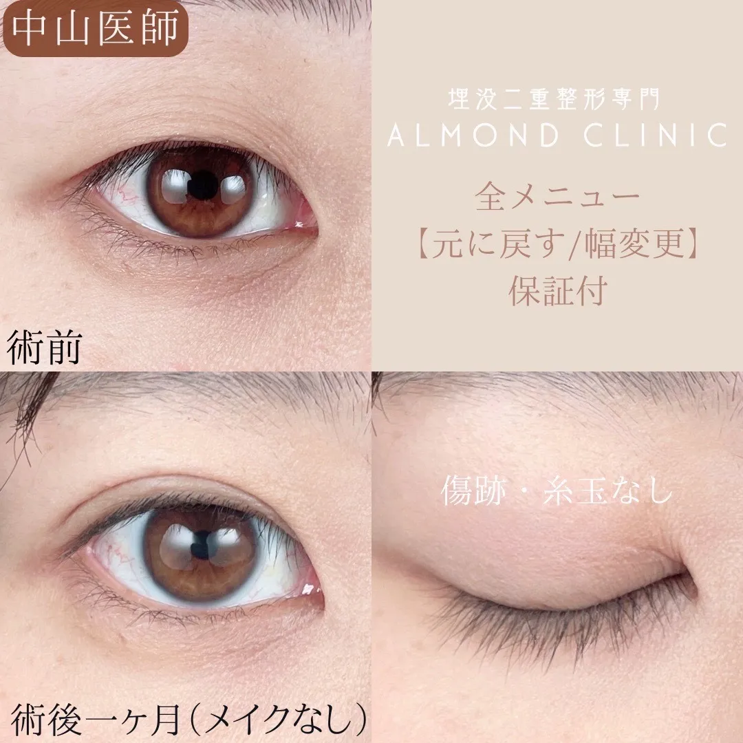 before・after画像