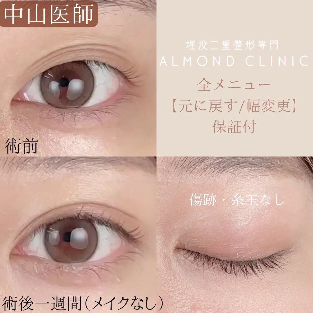 before・after画像