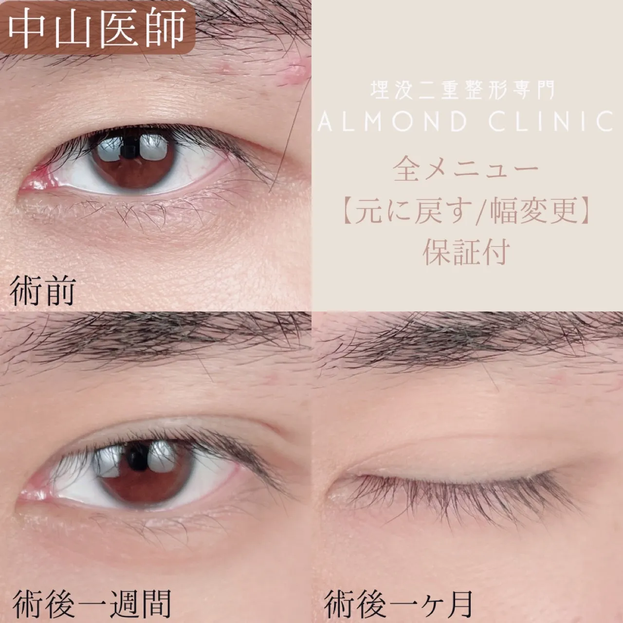 before・after画像