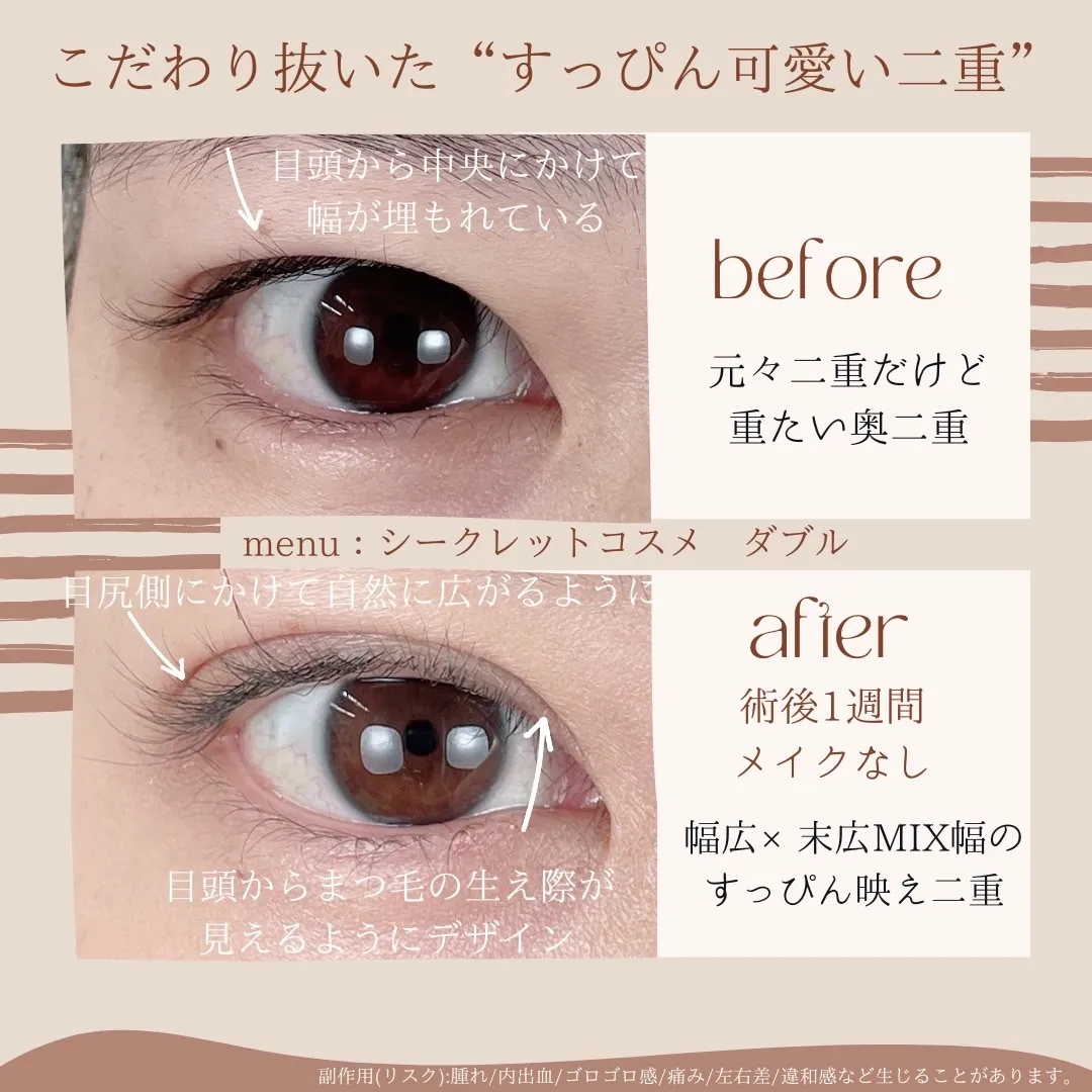 before・after画像