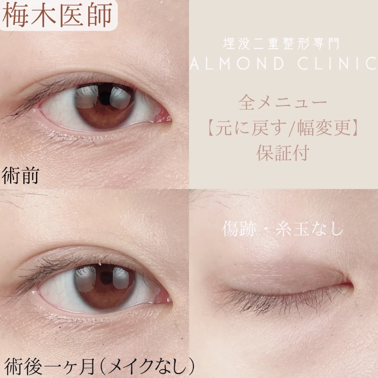 before・after画像