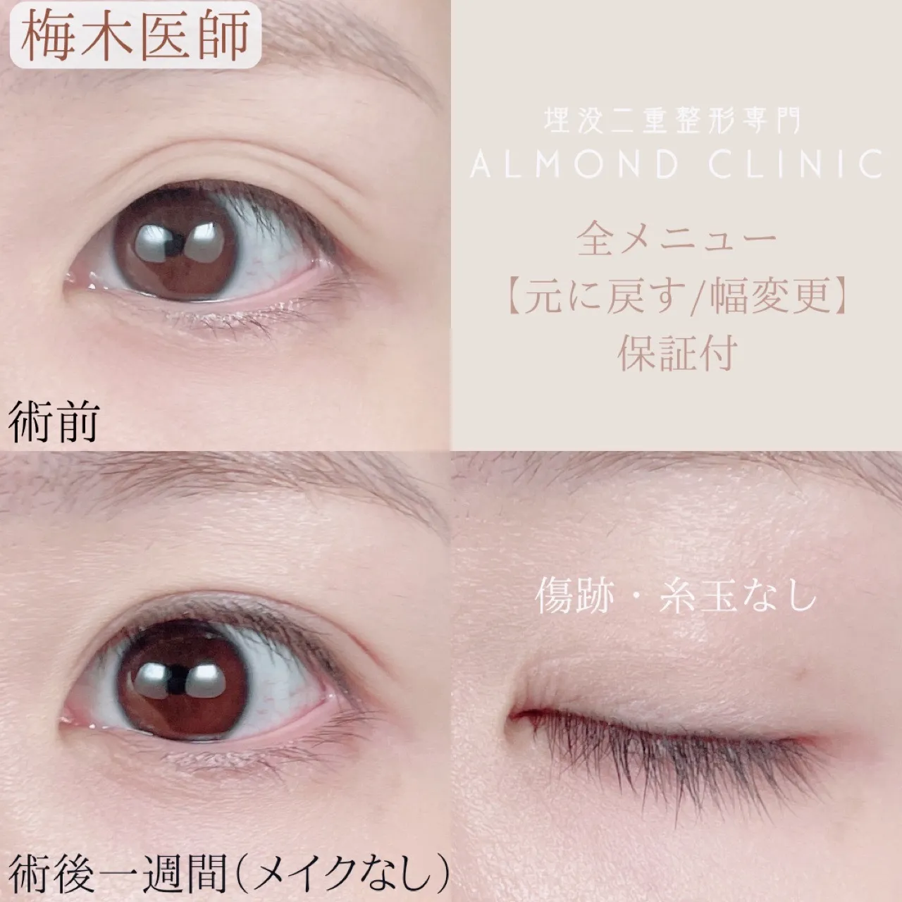 before・after画像