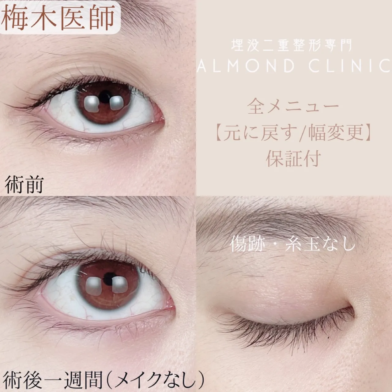 before・after画像