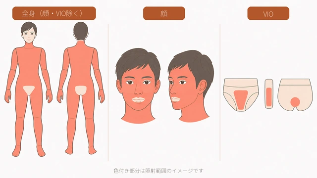 リゼクリニックの全身・顔・VIOの照射範囲イメージ