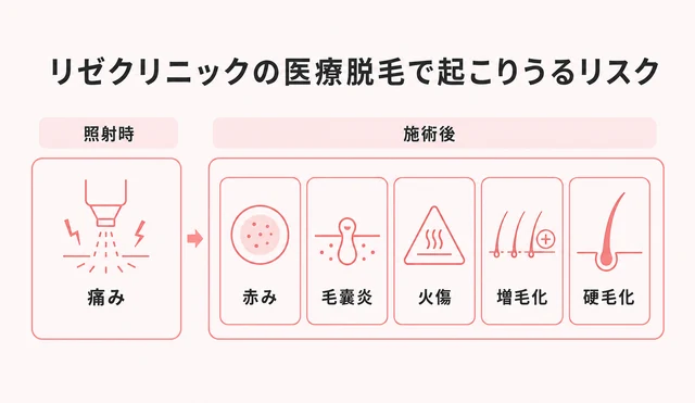 リゼクリニックの医療脱毛で起こりうるリスクをまとめた図解