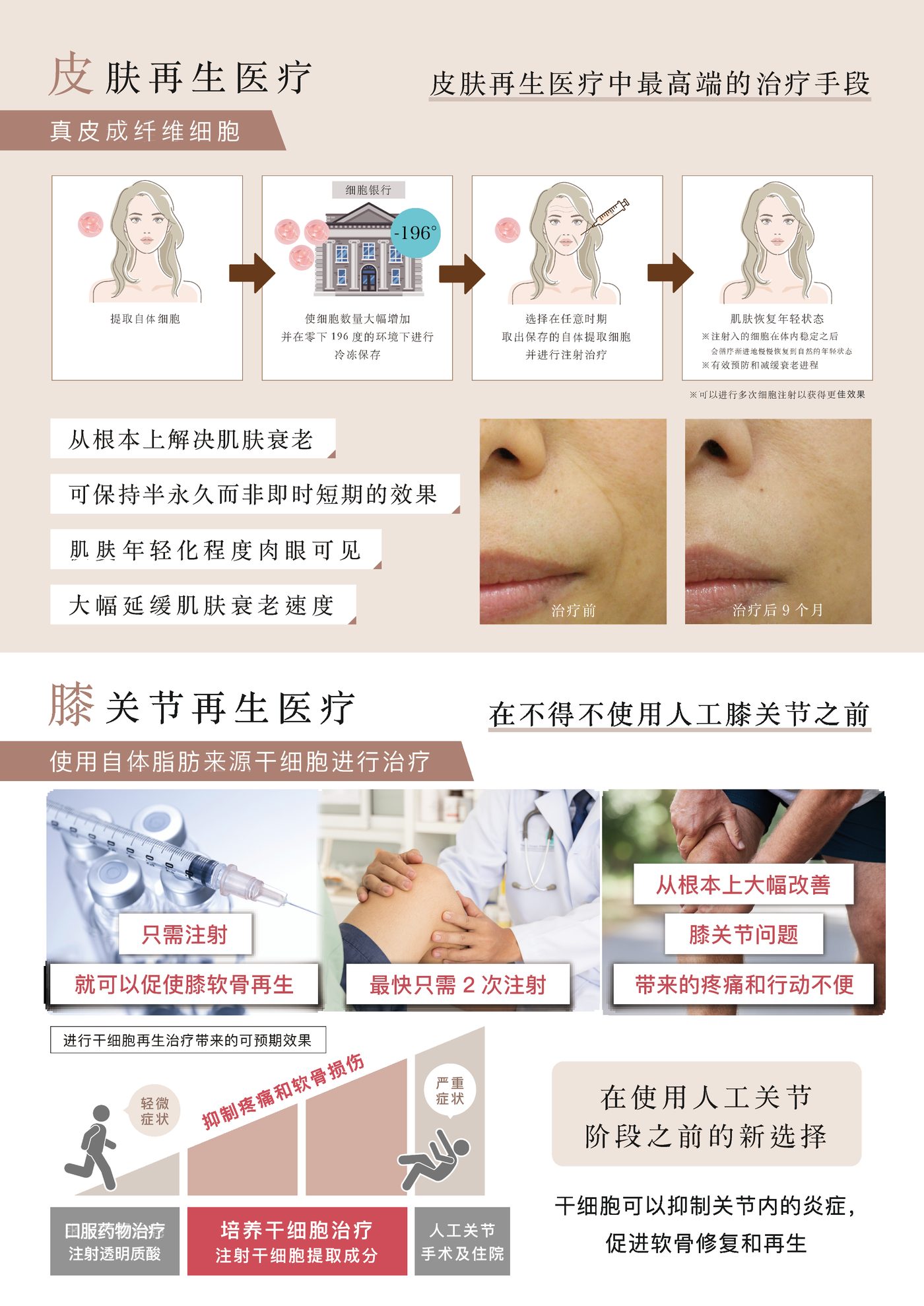 皮肤再生医疗・膝关节再生医疗