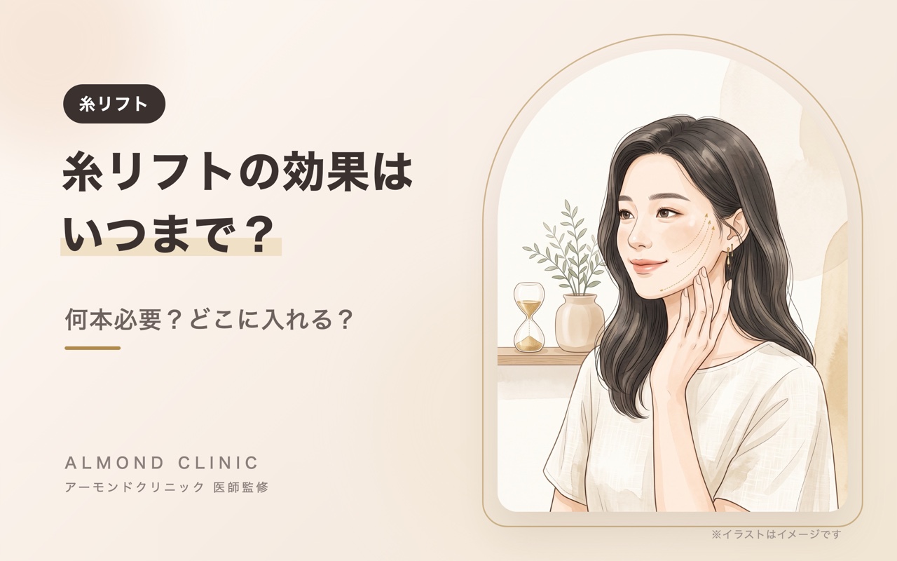 糸リフトの効果はいつまで？何本必要？どこに入れる？