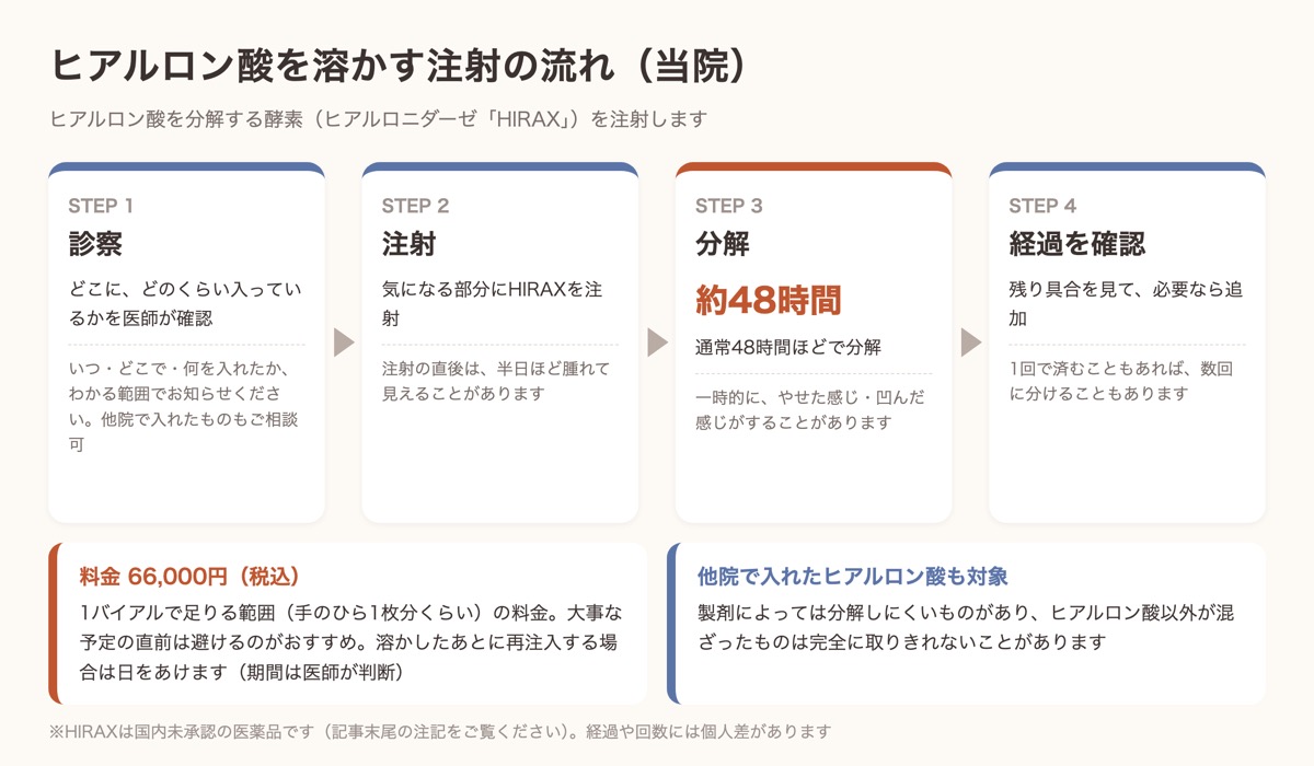 ヒアルロン酸溶解注射の流れ。診察、HIRAXの注射、約48時間で分解、経過を見て必要なら追加の4ステップ