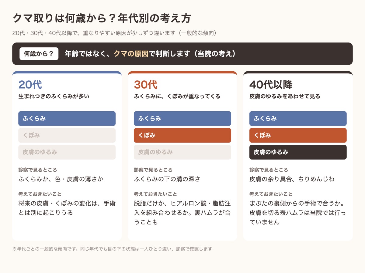 クマ取りは何歳からかを年代別に整理した図。20代はふくらみ、30代はくぼみ、40代以降は皮膚のゆるみが重なりやすい