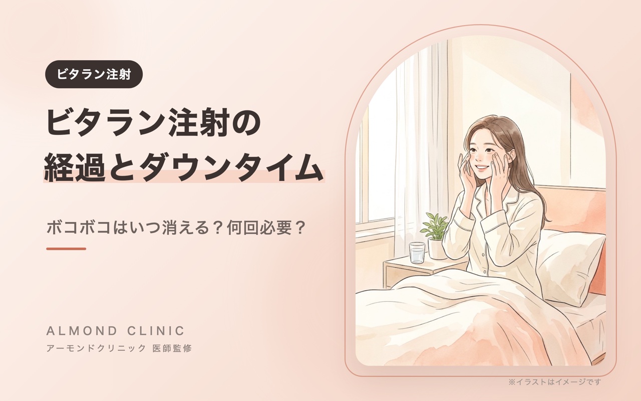 ビタラン注射の経過とダウンタイム ボコボコはいつ消える？何回必要？