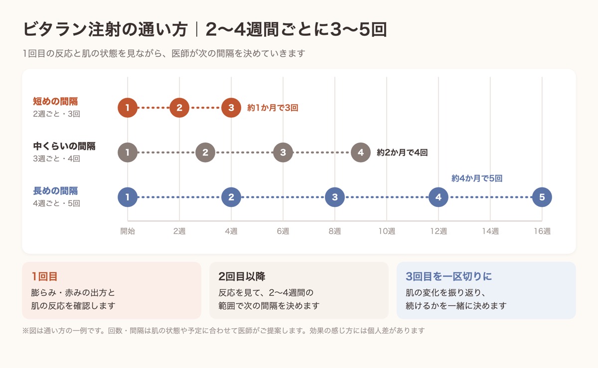 ビタラン注射の通い方の例。2週ごとに3回で約1か月、3週ごとに4回で約2か月、4週ごとに5回で約4か月