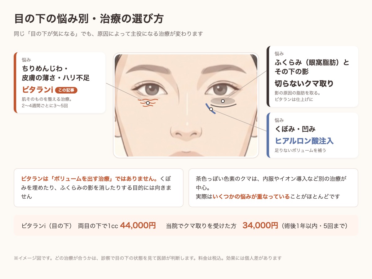 目の下の悩み別の治療の選び方。ちりめんじわ・皮膚の薄さはビタランi、ふくらみの影は切らないクマ取り、くぼみはヒアルロン酸注入