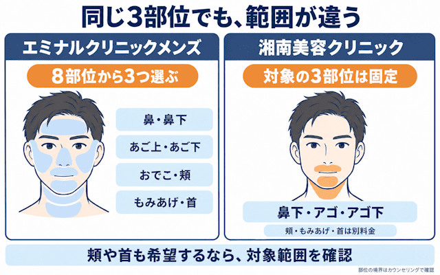 脱毛部位の選び方-メンズエミナルと湘南の違い