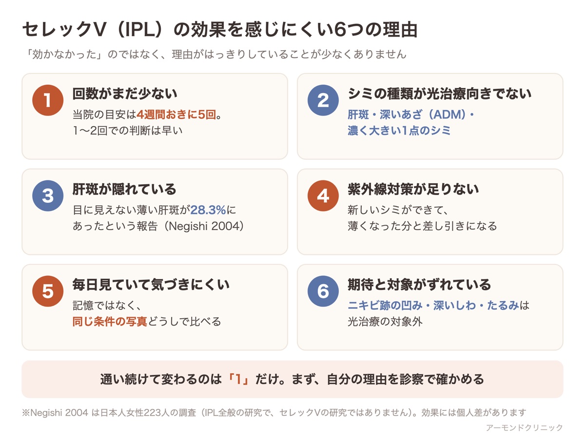 セレックV（IPL）の効果を感じにくい6つの理由（回数不足・シミの種類・隠れた肝斑・紫外線・見比べ方・期待とのずれ）をまとめた図