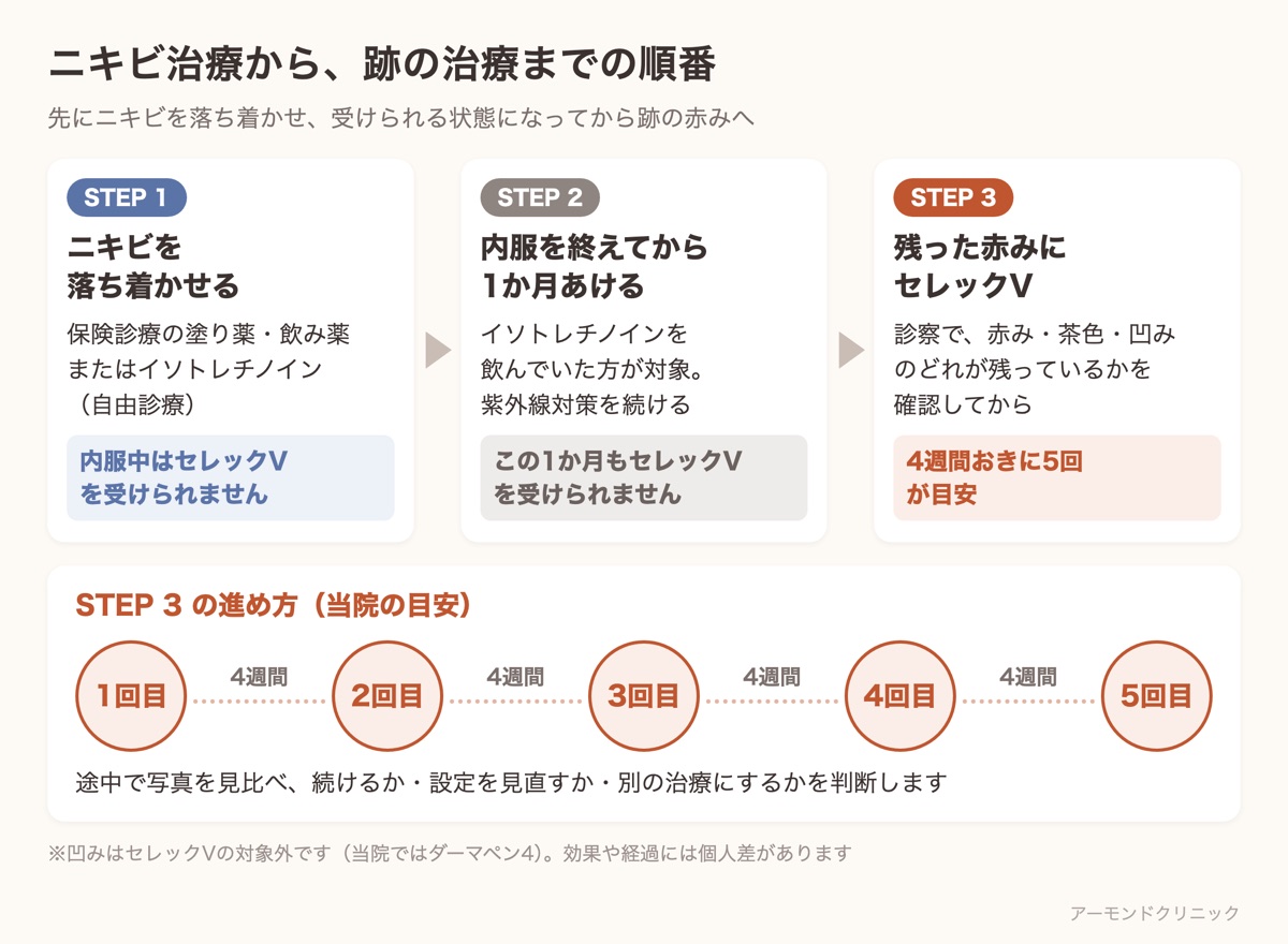 ニキビ治療から跡の治療までの順番。イソトレチノイン内服終了から1か月あけ、セレックVを4週間おきに5回受ける流れの図
