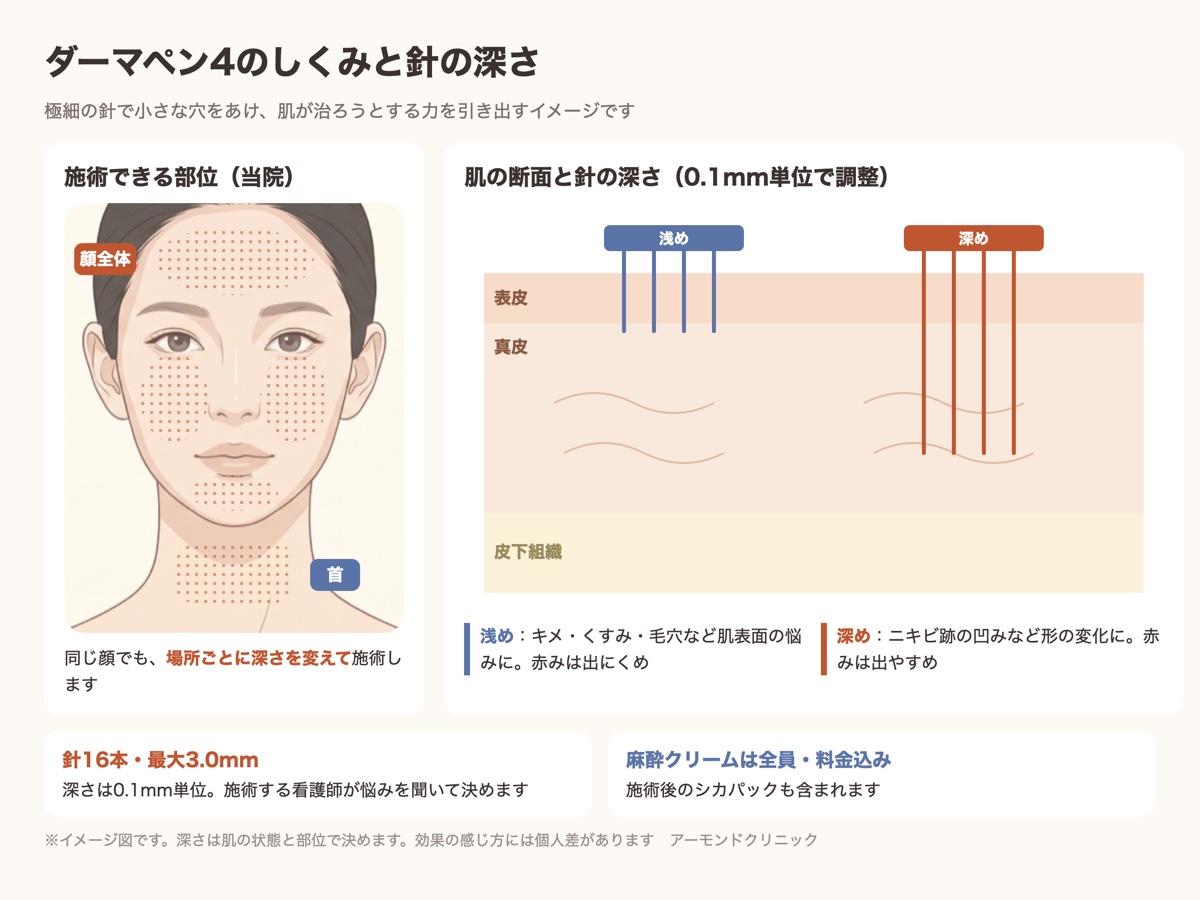 ダーマペン4のしくみと針の深さを示した図