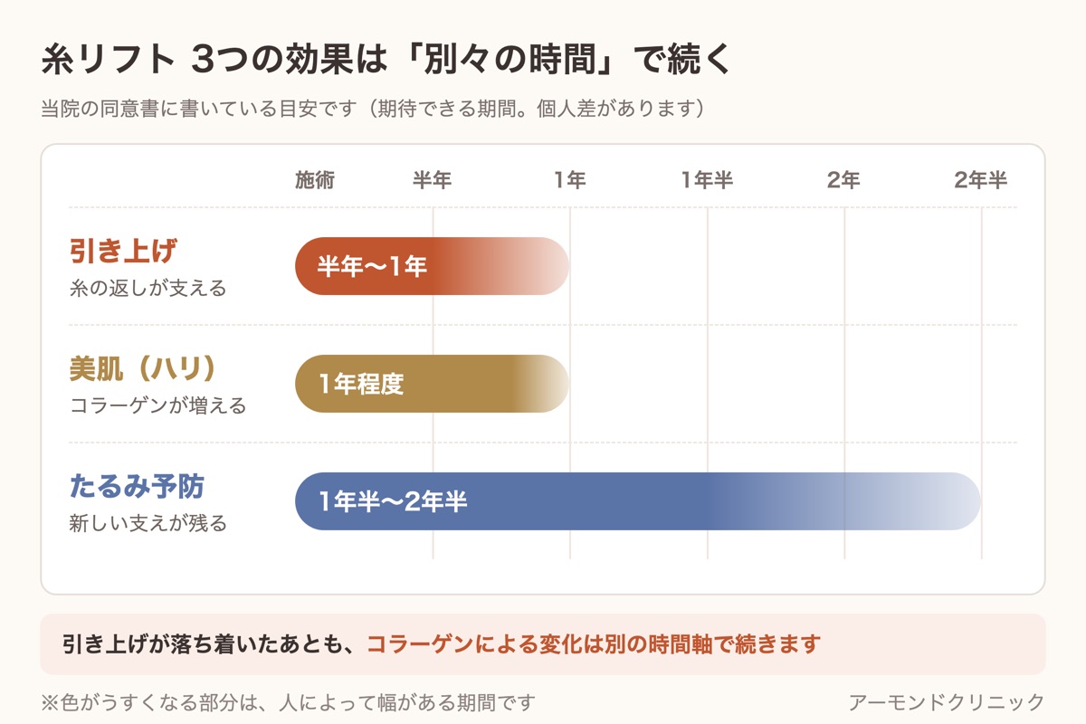 糸リフトの3つの効果の時間軸。引き上げは半年〜1年、美肌は1年程度、たるみ予防は1年半〜2年半が同意書の目安であることを示した図