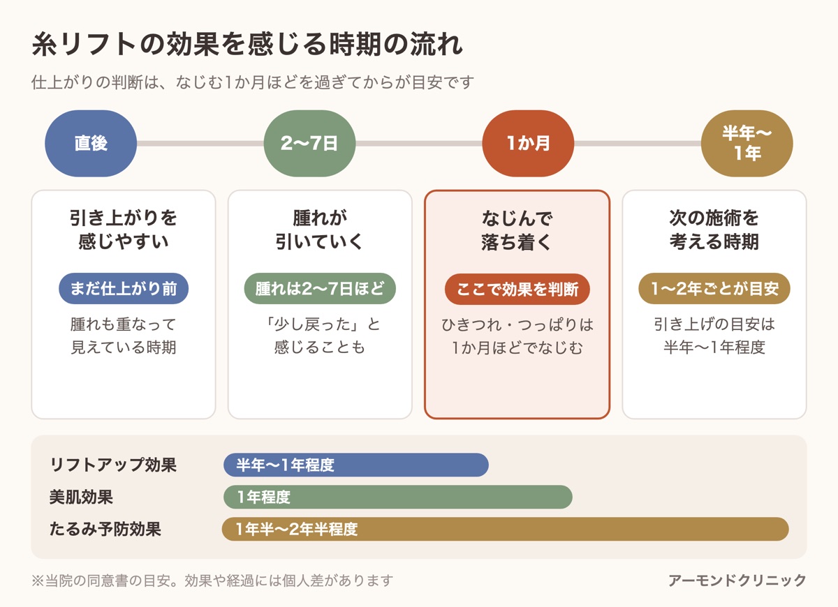 糸リフトの効果を感じる時期の流れ（直後・2〜7日・1か月・半年〜1年）と、リフトアップ・美肌・たるみ予防の3つの効果の目安の期間を示した図