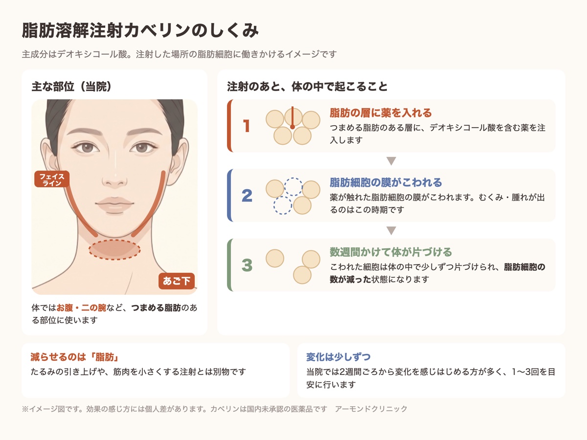 脂肪溶解注射カベリンのしくみと主な部位を示した図