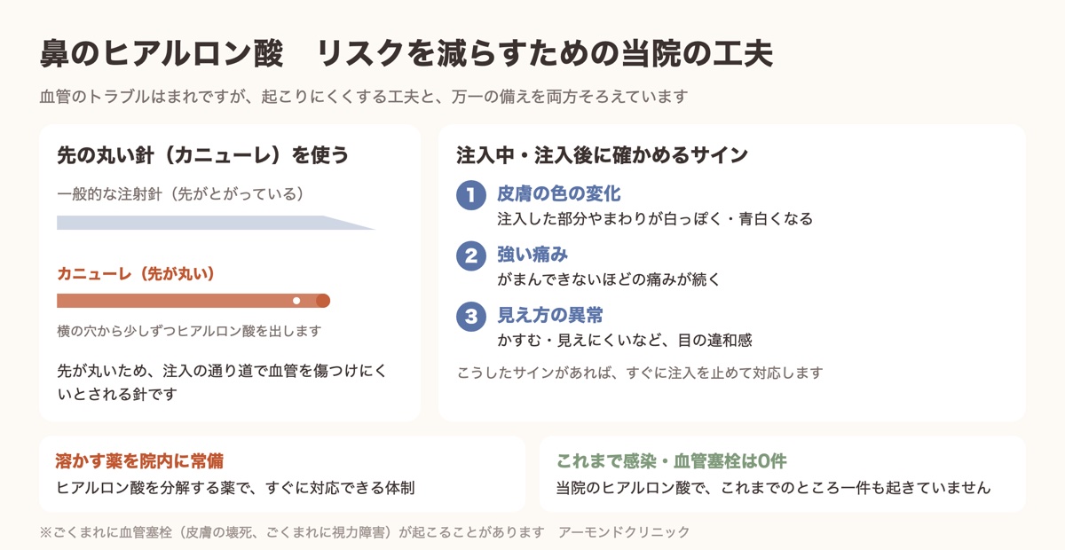 鼻のヒアルロン酸でリスクを減らすための当院の工夫(カニューレと確認するサイン)の図